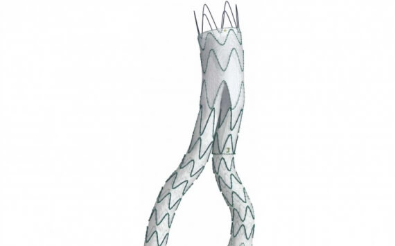 Endovascular - Endovascular