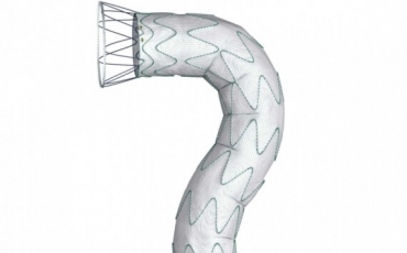 DOMINUS® ENDOPRÓTESE STENT-GRAFT