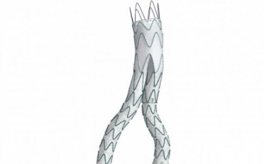 LINUS® ENDOPRÓTESE STENT-GRAFT